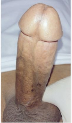 15196